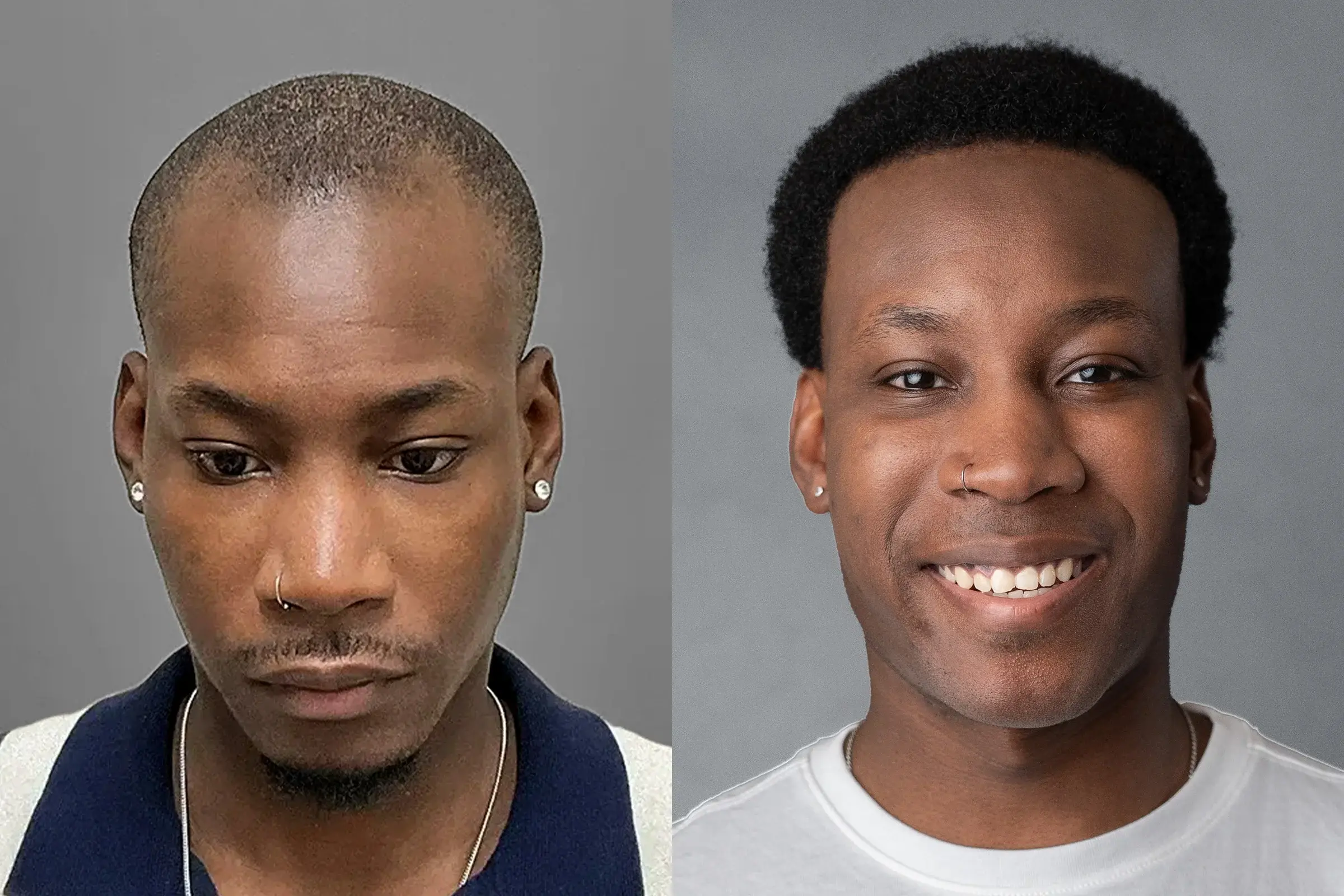 before and after sample photo-13