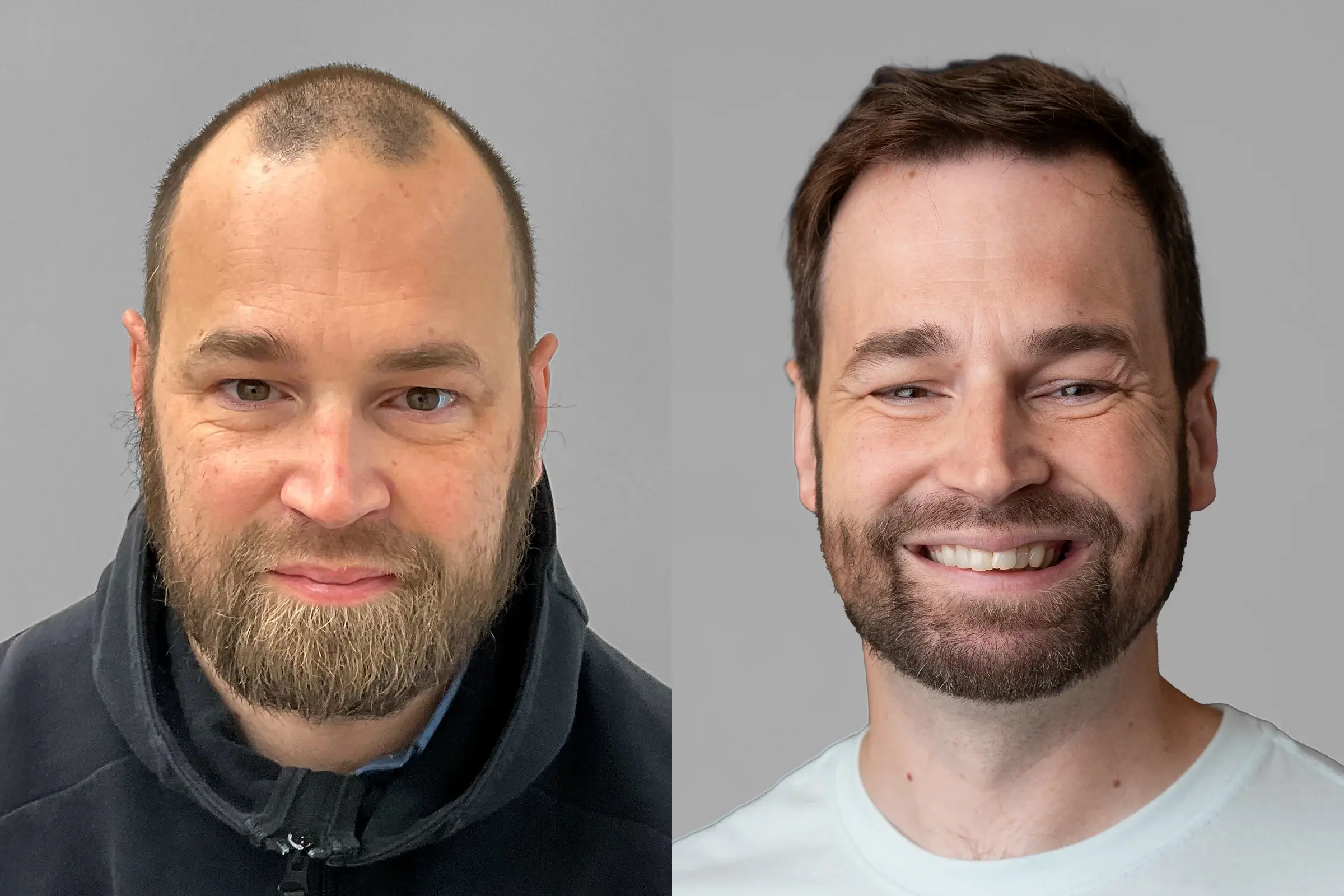 before and after sample photo-6