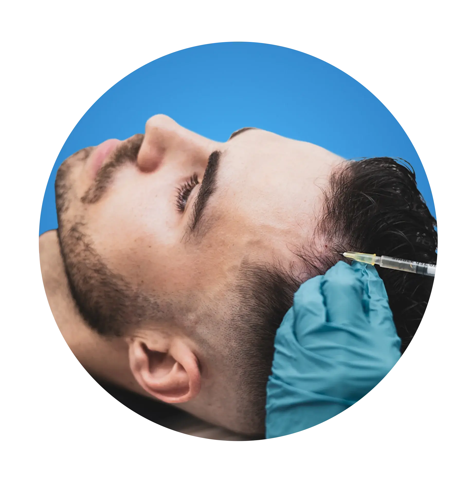 What is PRP and How Does It Work?