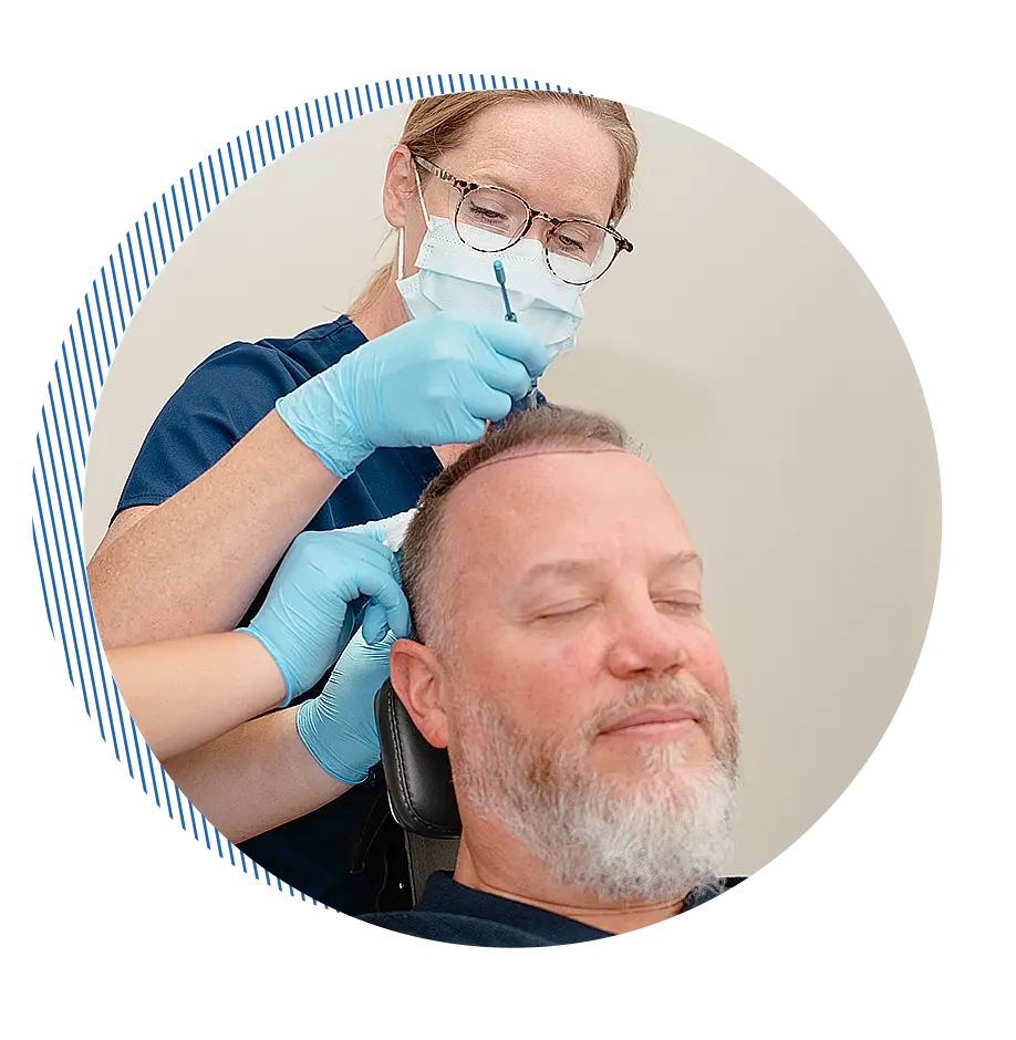 FUT vs FUE hair transplant