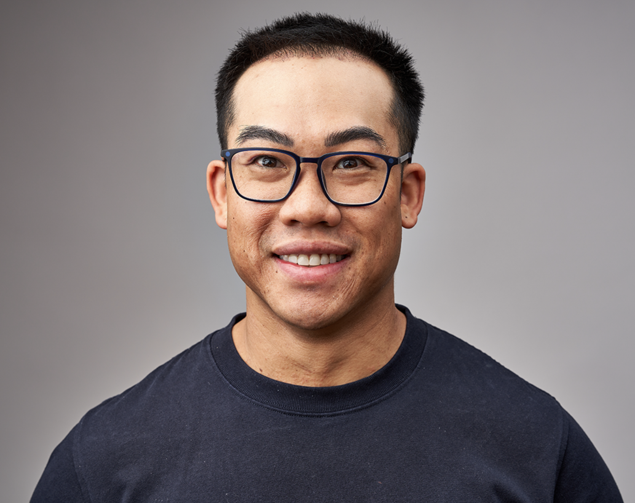 athens hair transplant after